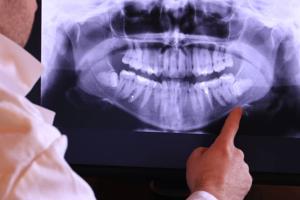 Best Broken or Chipped Tooth Repair in Vandalia, OH